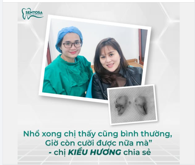 Nhổ 2 chiếc răng khôn nhẹ nhàng nhờ Piezotome – Feedback thực tế từ khách hàng