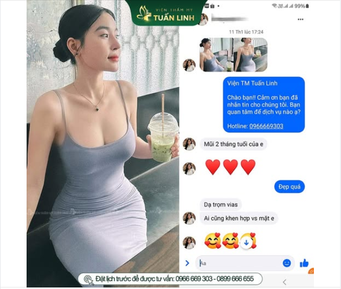 Feedback nâng mũi - 100% từ khách hàng thật.