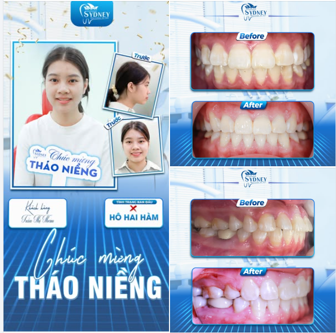 CHÚC MỪNG THÁO NIỀNG KH. TRẦN THƠM