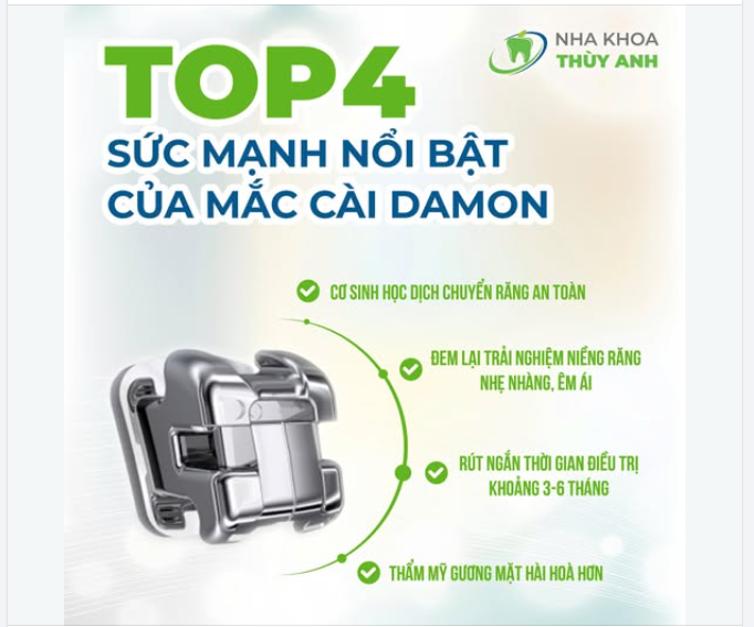 TOP 4 SỨC MẠNH NỔI BẬT CỦA MẮC CÀI DAMON