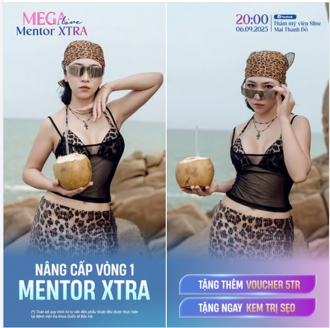 NÂNG CẤP VÒNG 1 – MENTOR XTRA
