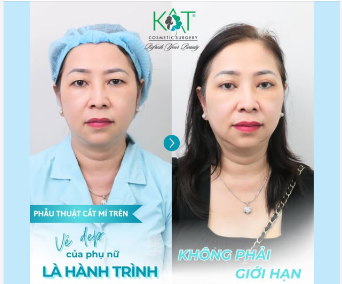 Làm đẹp là cả một quá trình – và phụ nữ ở bất kỳ độ tuổi nào cũng xứng đáng được rạng rỡ, tự tin.