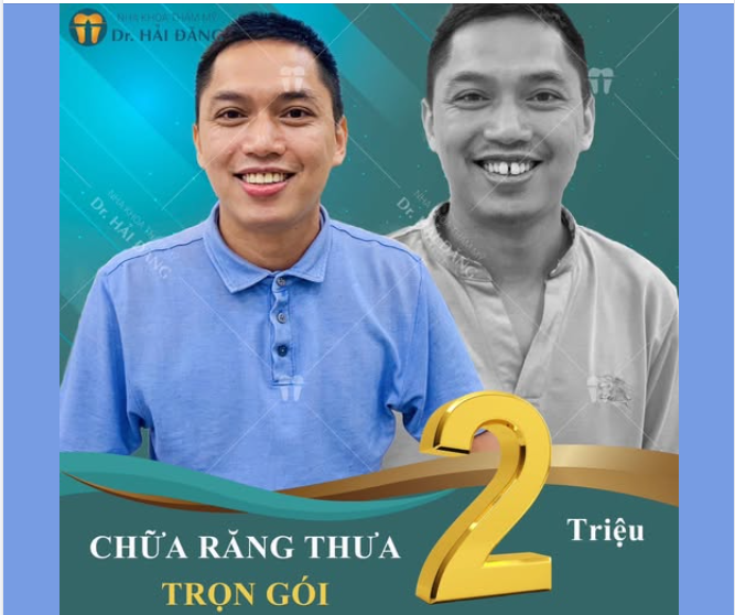 Tạm biệt nụ cười kém duyên - Chào đón nụ cười kém duyên