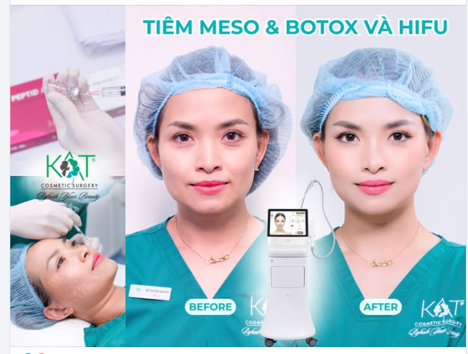 Sự kết hợp hoàn hảo MESO + BOTOX+ HIFU