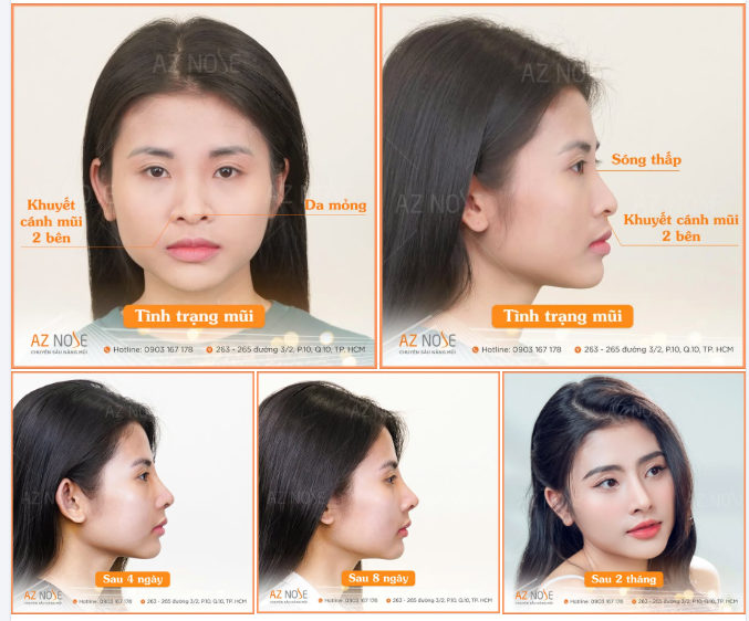 Từ ngày đầu đến sau 2tháng, TikToker Mỹ Ngân đã thay đổi thế nào