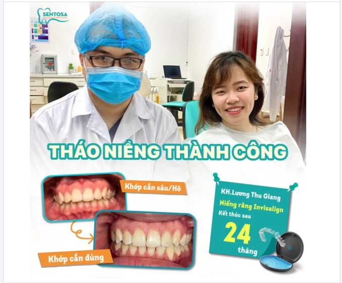 KẾT THÚC HÀNH TRÌNH SAU 24 THÁNG NIỀNG RĂNG INVISALIGN