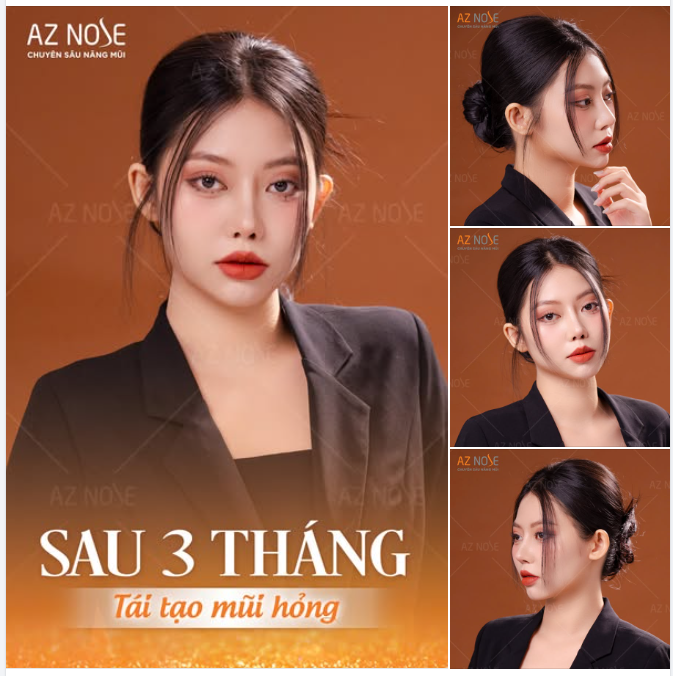 “Trộm vía sau khi sửa mũi mình đã có công việc mới với mức lương cao hơn...”