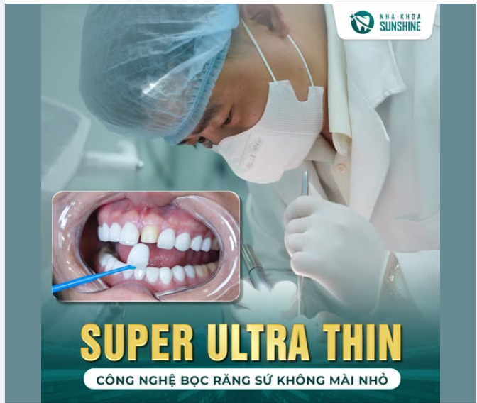 BỌC RĂNG SỨ MÀ KHÔNG MÀI NHỎ RĂNG? Bí quyết nụ cười đẹp không tổn hại răng thật!