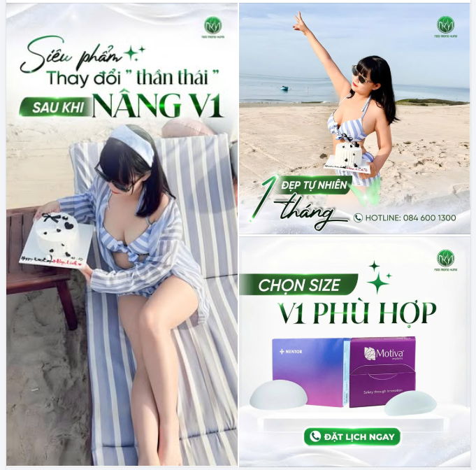Siêu phẩm thay đổi thần thái sau khi nâng V1