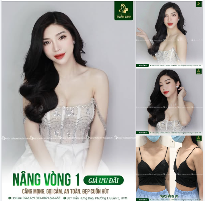 Nâng V1 - Căng mọng, gợi cảm, an toàn, đẹp cuốn hút - Giá chỉ từ 4X TR - Có hỗ trợ trả góp!!