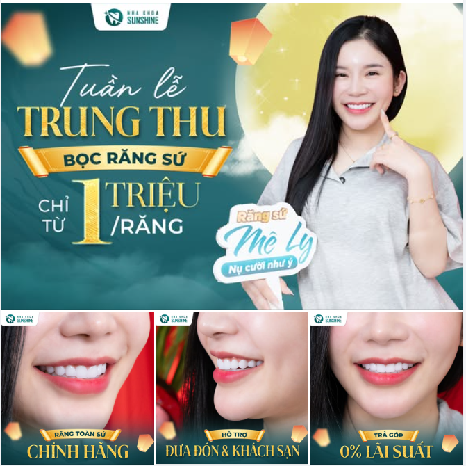 TUẦN LỄ TRUNG THU - RĂNG TOÀN SỨ CHỈ 1 TRIỆU/RĂNG