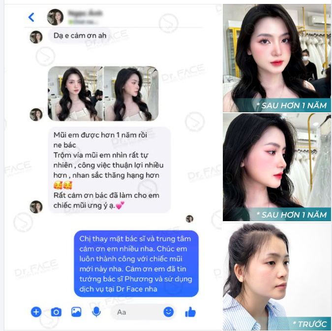Mũi cao tự nhiên chẳng cần tô vẽ,  Đẹp như thiên thần ghé xuống trần gian.