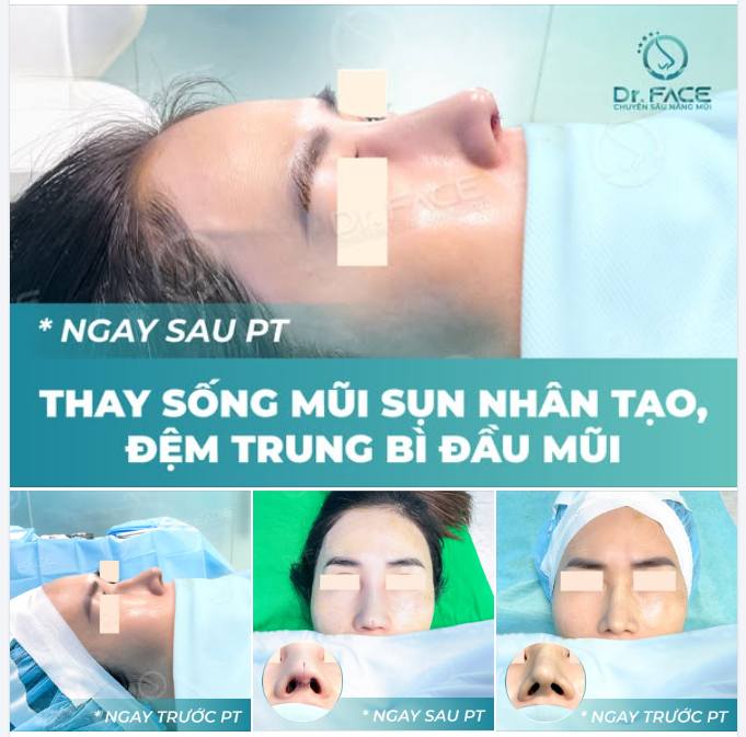 Đến DR.FACE, KHÔNG CHÈO KÉO thêm dịch vụ – mà còn GIẢM BỚT