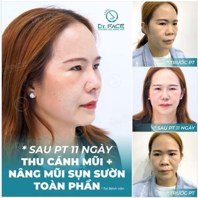 Cân nhắc ĐÀI – VIỆT, cuối cùng mới thấy CHỌN BS VIỆT NAM là đúng đắn