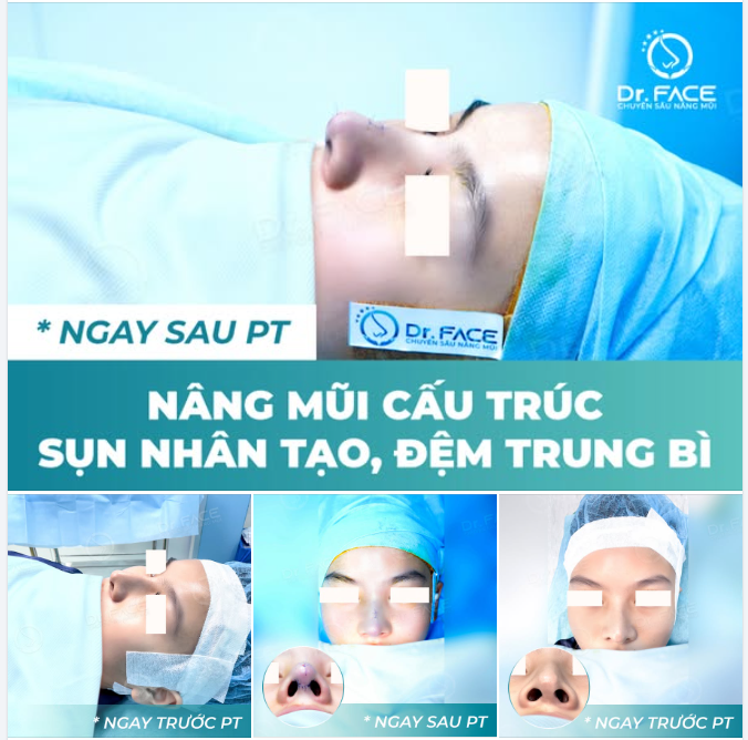 ĐẦU MŨI NHỌN đã là quá khứ – TRÒN MỀM mới là hiện tại