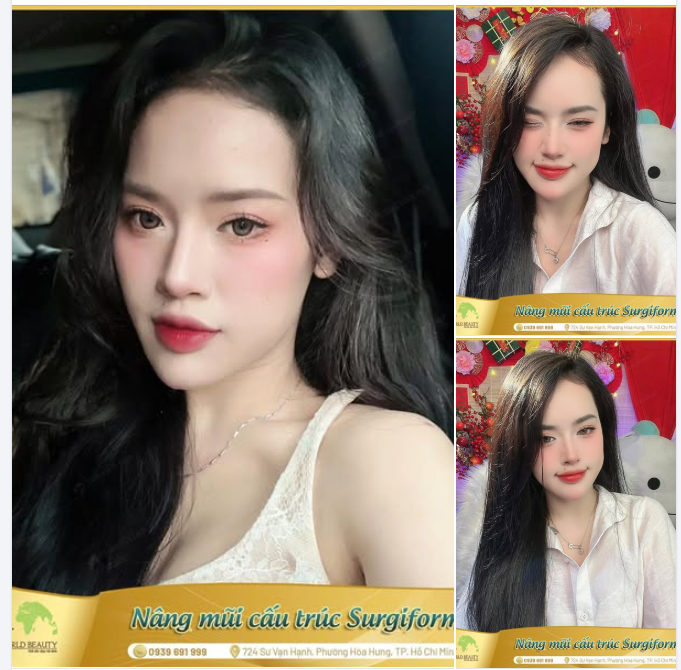 Lựa chọn Thế Giới Đẹp cho hành trình thăng hạng nhan sắc cho bản thân, Cô nàng đã tìm thấy dáng mũi hài hòa, tự nhiên và phù hợp với tổng thể gương mặt.