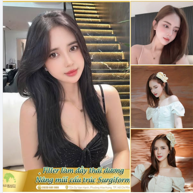 Bộ đôi kết hợp nâng mũi và làm đầy thái dương: Thay đổi toàn diện gương mặt từ dáng mũi thanh tú đến đường nét mềm mại trẻ trung, đầy sức sống.