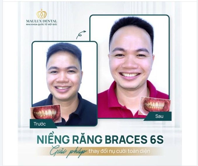 TỪ NỤ CƯỜI GƯỢNG GẠO ĐẾN TỰ TIN RẠNG NGỜI