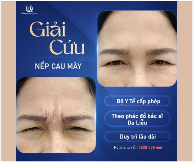 YOUTHFUL BROW - HẾT NHĂN CAU MÀY – GIỮ MÃI NÉT XUÂN THÌ