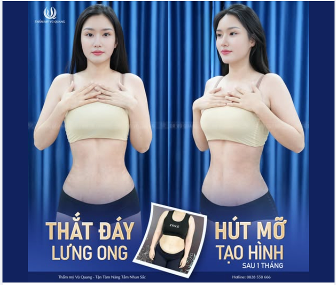 SAU 1 THÁNG - TRẢ VỀ BODY 0 ĐIỂM Ư  CỤ THỂ LÀ KHÔNG ĐIỂM NÀO ĐỂ CHÊ