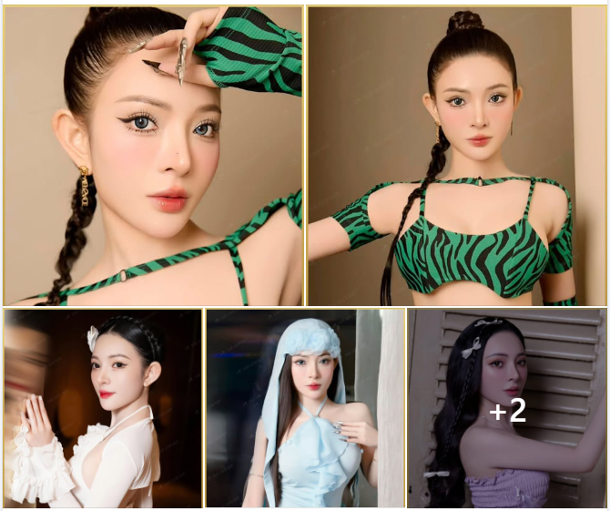 Qúy Cô từng n.âng cấp mũi trước đó ở nơi khác nhưng không vừa ý đã quyết định tìm đến Thế Giới Đẹp để "sửa sai" trong tình trạng mũi với nhiều khiếm khuyết: