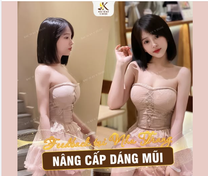 Feedback Nâng Mũi ALINE – Tự tin hơn với diện mạo mới