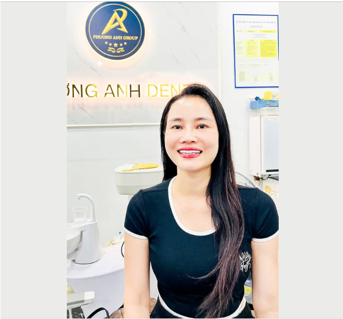 Cảm giác sau khi làm xong răng đúng là… “không thể tin nổi”!