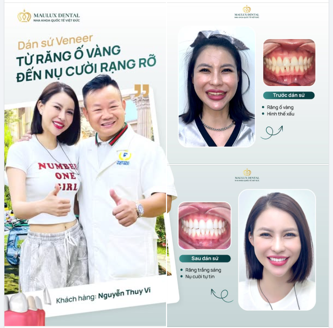 HÀNH TRÌNH THAY ĐỔI NỤ CƯỜI CỦA THÚY VI - KHI SỰ KHẮT KHE CHẠM ĐẾN SỰ HOÀN HẢO