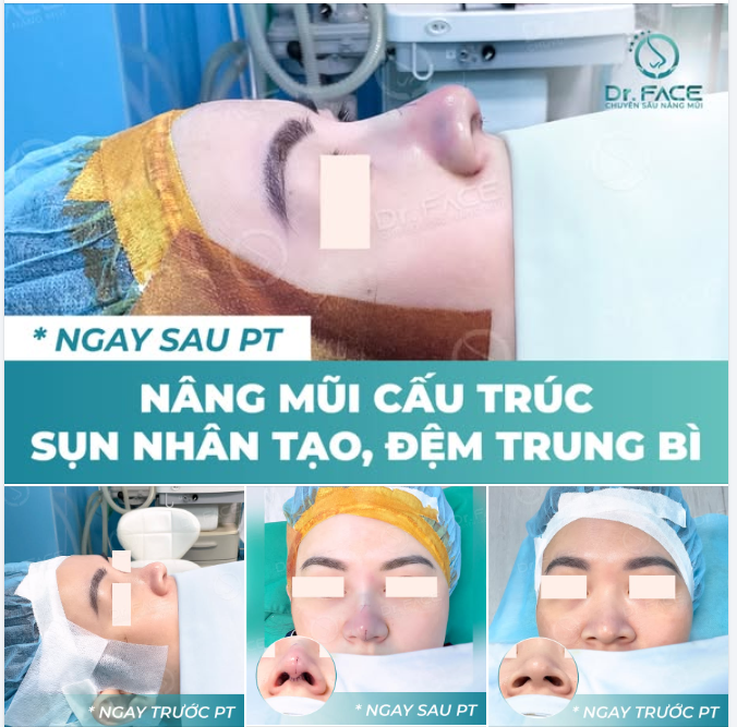 ĐỐ BẠN CA NÀY CÓ THU CÁNH MŨI KHÔNG?