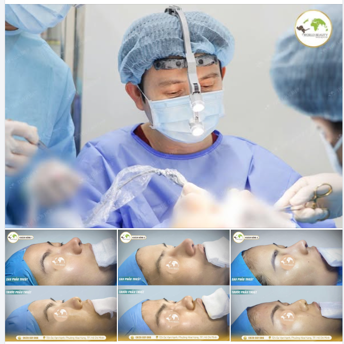Cùng Thế Giới Đẹp xem qua thành quả được ekip phòng mổ ghi lại sau khi hoàn thiện.