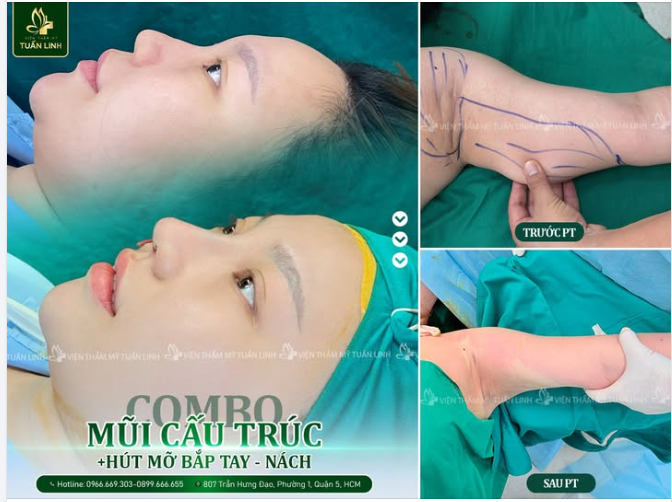 LÀM ĐẸP COMBO NHẬN THÊM ƯU ĐÃI TẠI TUẤN LINH!!