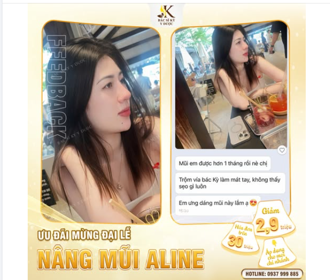 Ưu đãi đặc biệt tháng 9 - Nhận ngay 2tr9 khi Nâng Mũi ALINE