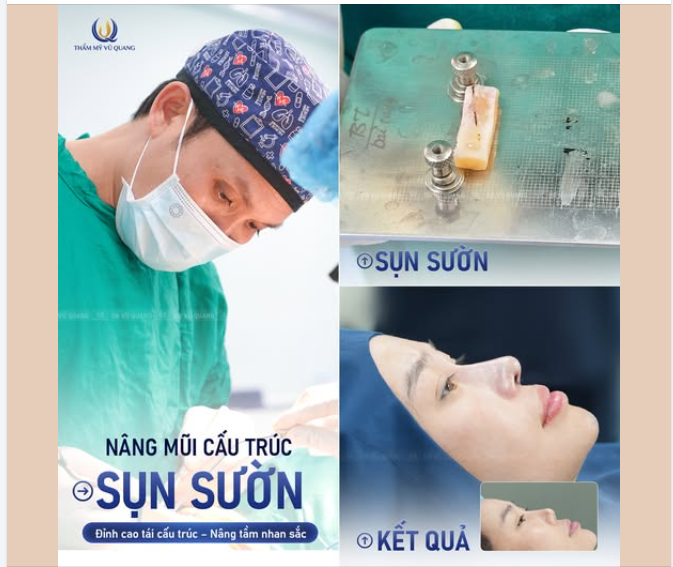 MŨI SỬA ĐẾN LẦN THỨ 5 – GIẢI PHÁP NÀO CỨU CÁNH?