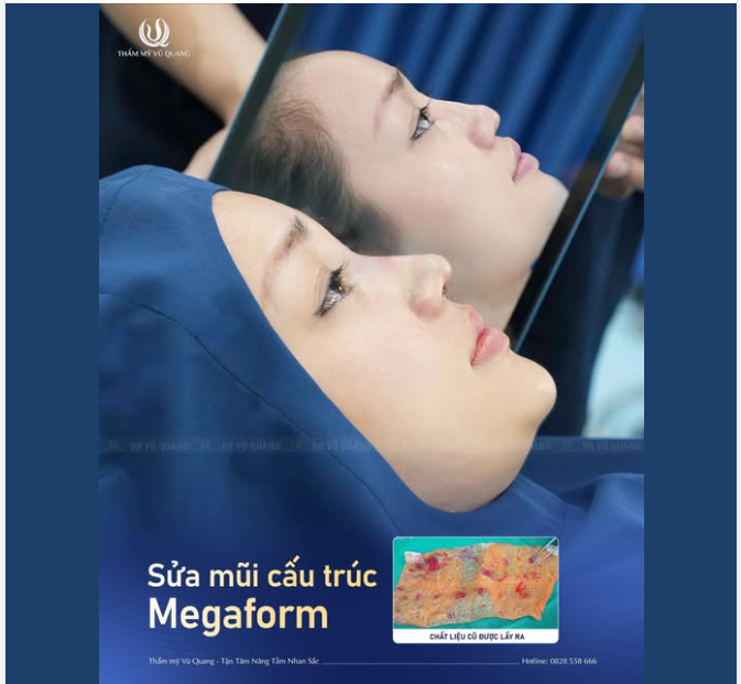 Muốn sửa mũi nhưng còn chần chừ?  Bởi ai cũng hiểu rằng một lần hỏng đã là quá đủ...