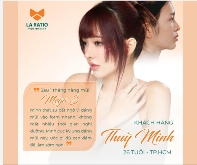 KHÁCH HÀNG REVIEW THỰC TẾ – 1 tháng sau nâng mũi MegaS