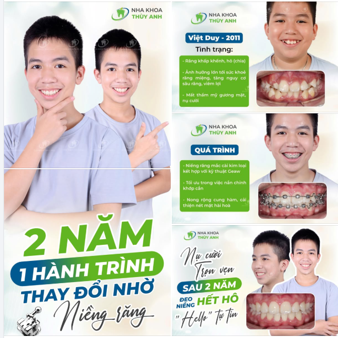 NỤ CƯỜI TỰ TIN CỦA CON NGÀY HÔM NAY - BẮT ĐẦU TỪ QUYẾT ĐỊNH CỦA BA MẸ