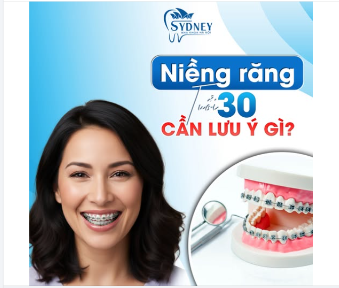NIỀNG RĂNG TUỔI 30 CẦN LƯU Ý GÌ ĐỂ ĐẢM BẢO HIỆU QUẢ?