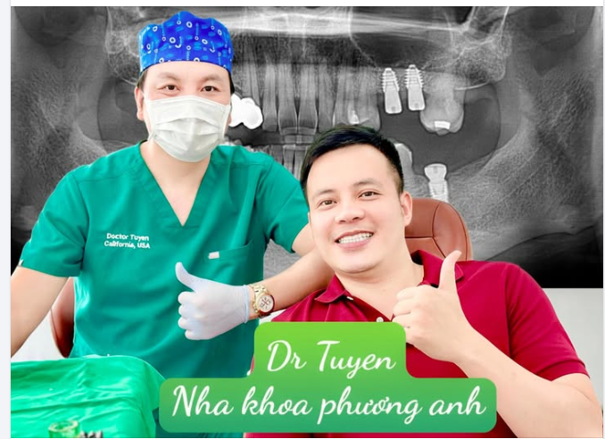 Rút ngắn tối đa thời gian với Implant nha khoa tức thì