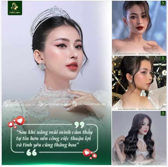 Nâng mũi không chỉ là nâng cao sóng mũi mà: Nâng mũi còn thay đổi, nâng tầm nhan sắc giúp bạn xinh đẹp, tự tin và tỏa sáng hơn.