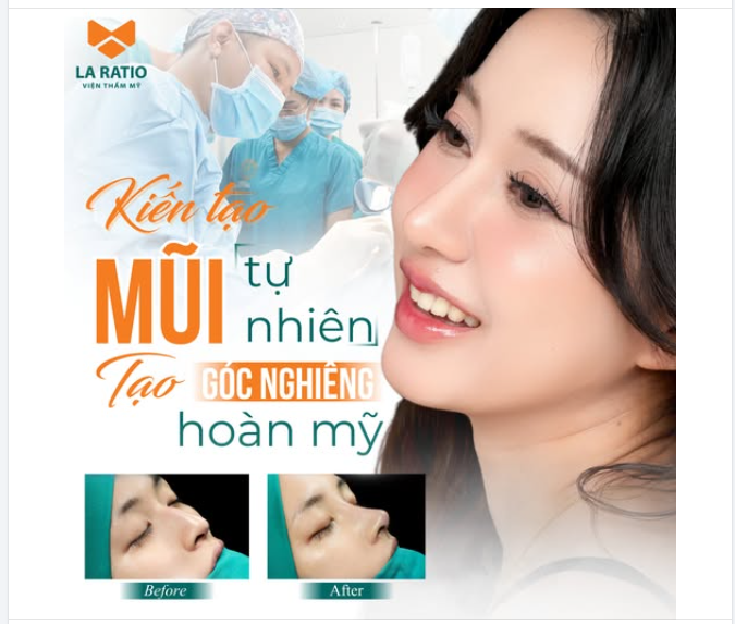 Bác sĩ bật mí Vì sao dáng mũi tự nhiên luôn là “chân ái” của hội xinh gái?