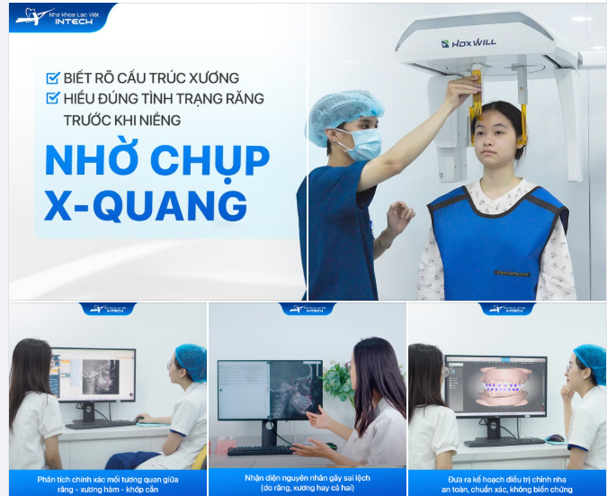 BIẾT RÕ CẤU TRÚC XƯƠNG - HIỂU ĐÚNG TÌNH TRẠNG RĂNG TRƯỚC KHI NIỀNG!