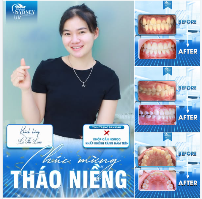 CHÚC MỪNG THÁO NIỀNG KH. LÊ LAM