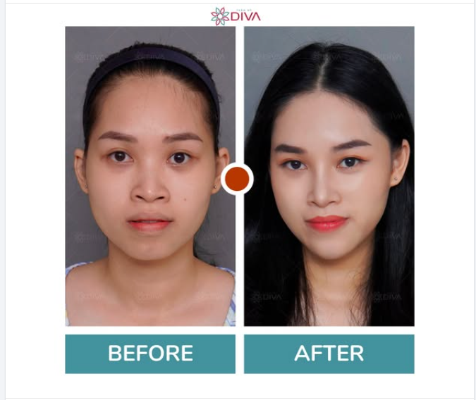 THẦN THÁI TƯƠI TẮN - NGOẠI HÌNH XINH XẮN VÀ THU HÚT HƠN SAU TM
