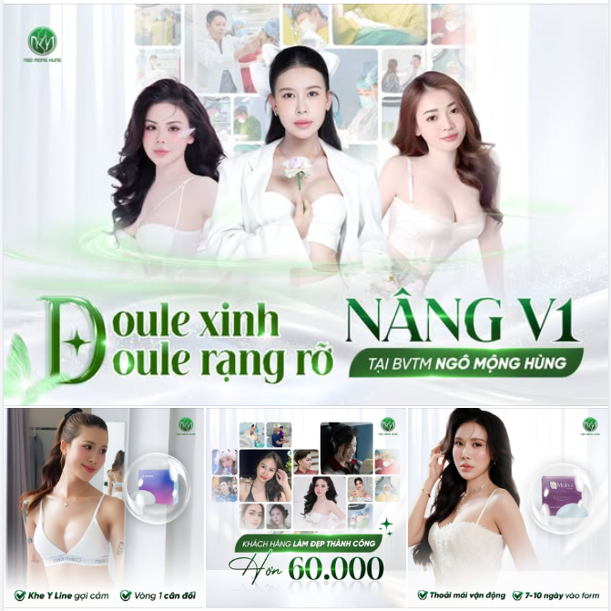 Doule xinh doule rạng rỡ  Rất nhiều khách hàng sau khi lựa chọn nâng V1 tại BVTM Ngô Mộng Hùng đều sở hữu: