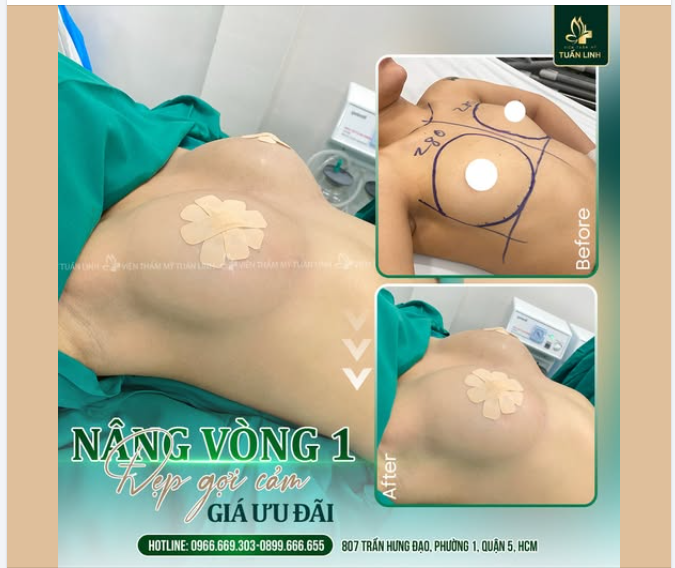 NÂNG CẤP V1 - NÂNG CẤP SỰ TỰ TIN - ĐẸP QUYẾN RŨ, ĐẦY GỢI CẢM!!!