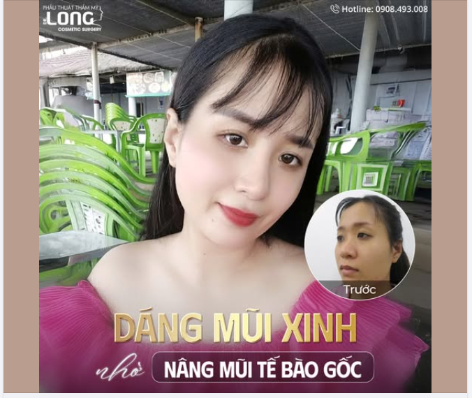 BẠN THÍCH SỰ XINH ĐẸP NHƯNG NGẠI PHẪU THUẬT