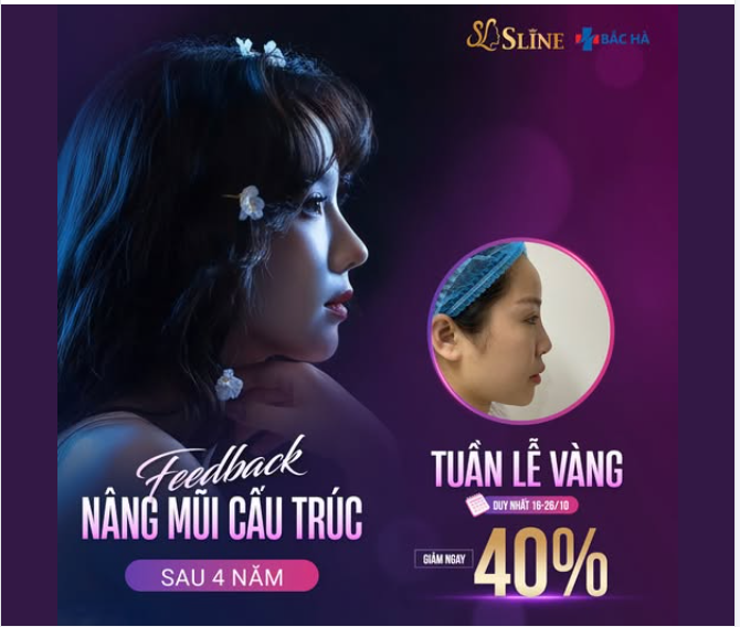 GIẢM ĐẾN 40% – TUẦN LỄ VÀNG NÂNG MŨI  ƯU ĐÃI LỚN NHẤT THÁNG 10 – TỪ NGÀY 16–26/10