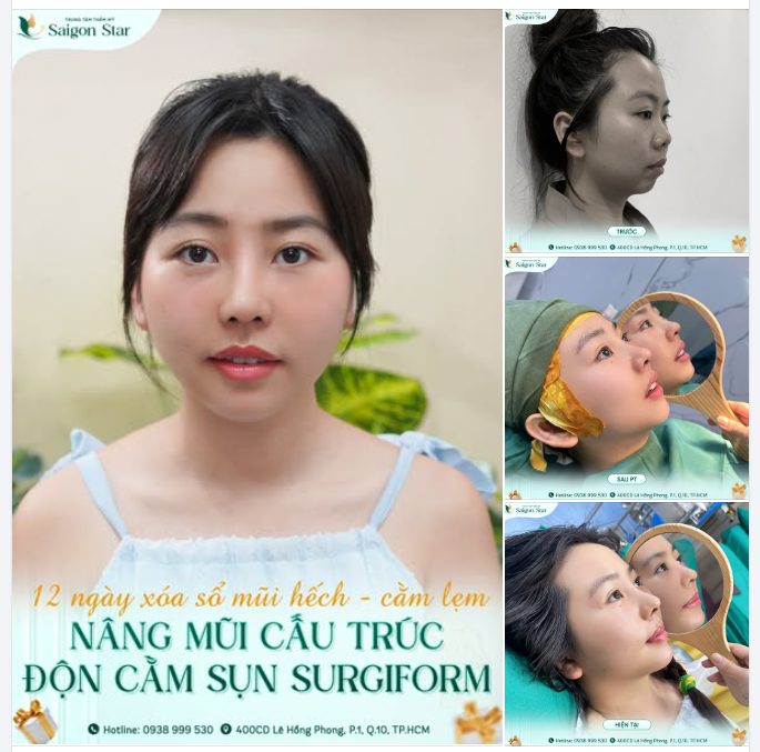 XIN CHÀO PHIÊN BẢN NÀNG THƠ SAU 12 NGÀY "TÁI SINH"!