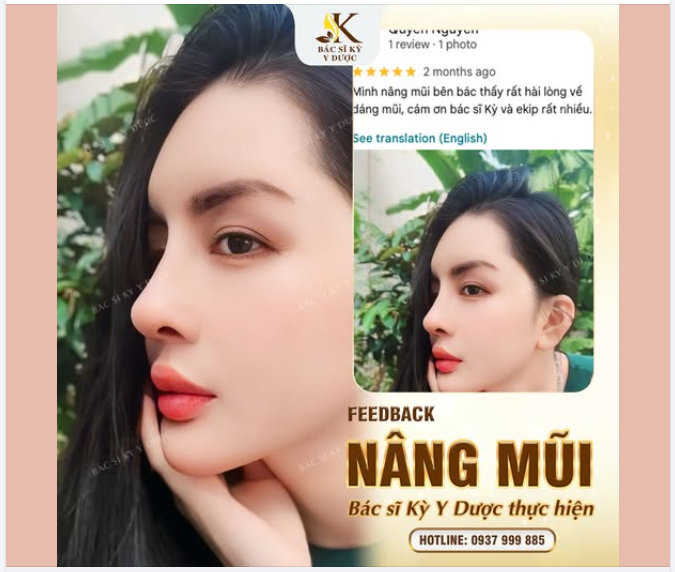 Feedback thực tế từ khách hàng sau khi Nâng Mũi tại Bác sĩ Kỳ Y Dược