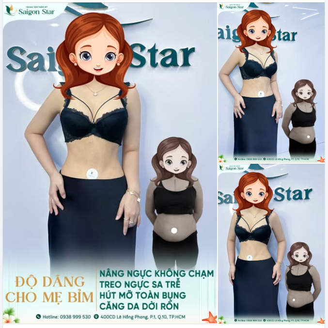 KẾT QUẢ VIÊN MÃN SAU 10 NGÀY "LỘT XÁC" CHO MẸ BỈM SỮA